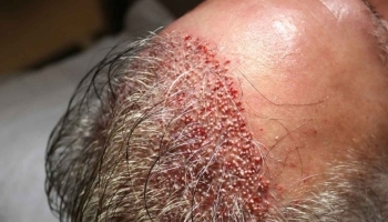 ������ ��������� ����� �������������� ��������