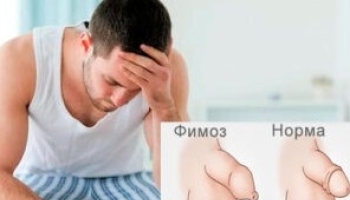 ��� ����� ����� � ������