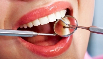 Важность и значимость реставрации зубов